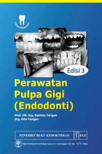 Image of Perawatan Pulpa Gigi